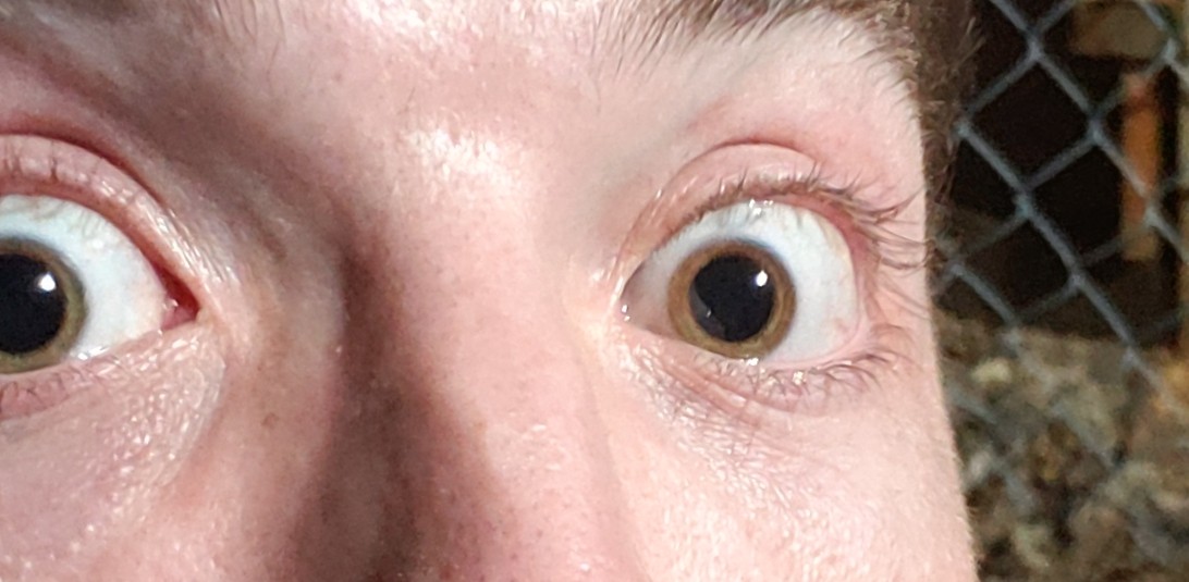 close up of wide open green eyes, with MASSIVELY dilated pupils